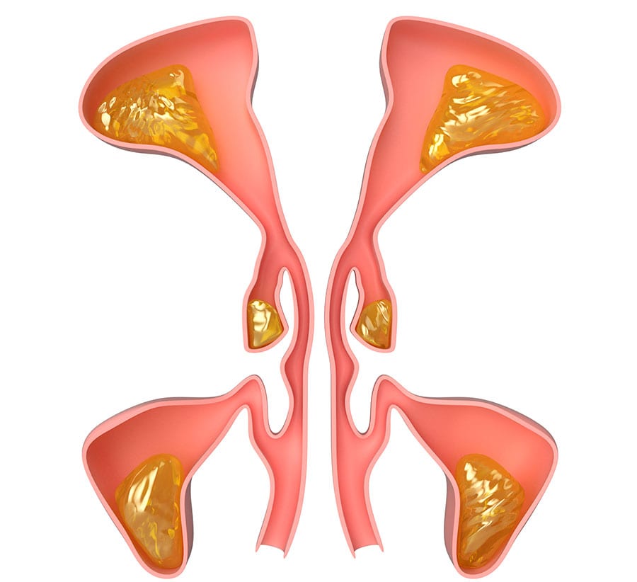 Sinus-Surgery-Specialist-Nasal-&-Sinus-Surgery-Center Sinus-Surgery-Specialist-Nasal-&-Sinus-Surgery-Center
